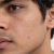 texturous skin